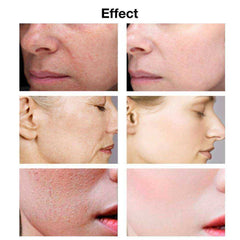 Acid Face Serum Whitening Skin Care