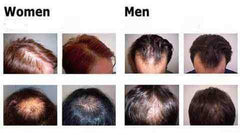Organic Hair Growth Nourishing Essence Oil Serum