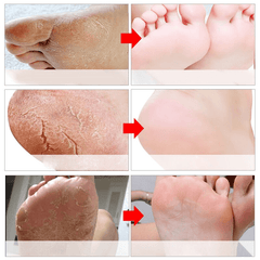 Exfoliating Foot Masks Pedicure Socks
