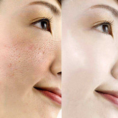 Acid Face Serum Whitening Skin Care
