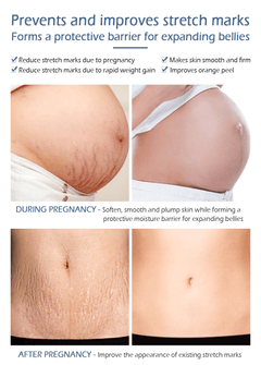 Crocodile Stretch Marks Remover Body Repair Cream