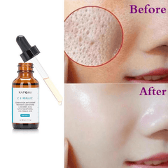 Facial Vitamin Repair Antioxidant Spot Whitening Essence